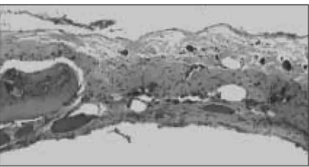 Fig. 2. Histopathologic  findings  in  the  control  group at 8 weeks. New-bone formation is only seen  adja-cent to the defect margin (H&amp;E stain, original  mag-nification ×100).