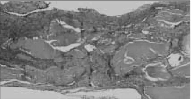 Fig. 4. Histopathologic findings in the group with par- par-ticulate dentin and plaster of Paris alone at 8 weeks.