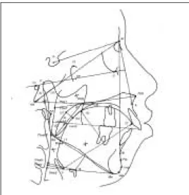 Fig. 3. Position of the hyoid Fig. 4. Dimension of the tongue &amp; the soft palate