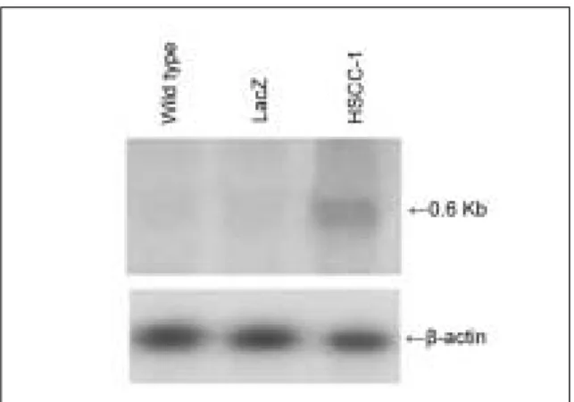 Fig. 4. Viability  of  SCC-25  cells  after  transduction  with AdCMV-HCCS-1, AdCMV-LacZ, and wild-type SCC-25 cells