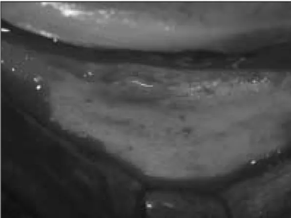 Fig. 2. Post-extaction : extraction of 2nd &amp; 3rd &amp; 4th premolars and 1st molar