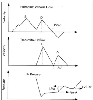 Fig. 1. Parameters of pulmonary venous(upper), mitral (middle) flow and left ventricular pressure  (bott-om) curves