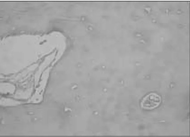 Fig. 4. Histologic findings of dense irregular connective tissue under the titanium mesh of case 1(H&amp;E, X100).
