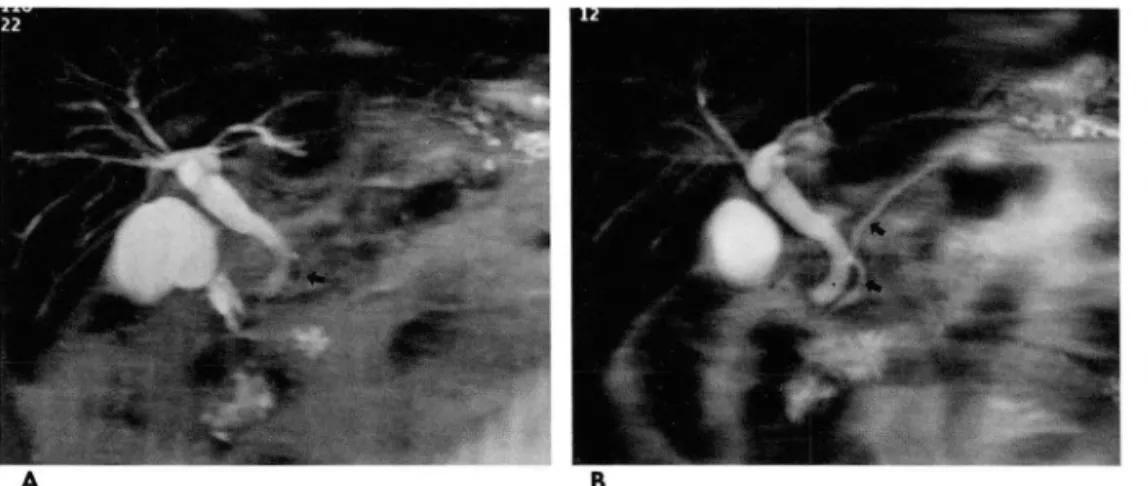 Fig .  1.  A  5 4- year-old man 