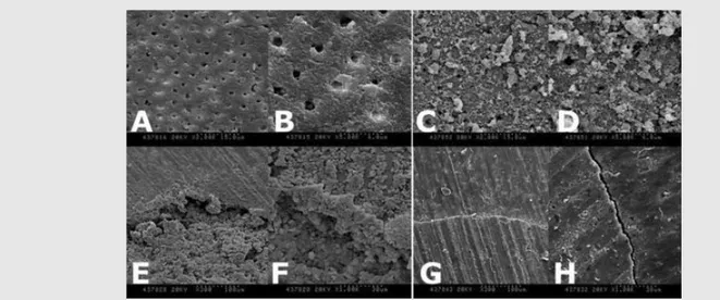 Figure 2. Scanning electron micrographs of the dentin surface after preparation of the cavity (A-D) and material/tooth interface after retrograde filling  (E-H)