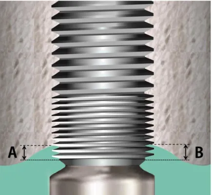 Figure 4. Schematic illustration of the site and reference point measurements. A and B, 