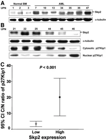 Fig. 1 Western blot analysis of Skp2 and p27Kip1 protein expression