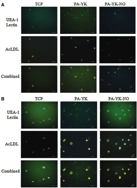 FIG. 3. UEA-1 Lectin staining and acetylated  low-density lipoprotein (ac-LDL) uptake on TCP, PA-YK, and PA-YK-NO on day 7 (A) and day 14 (B)