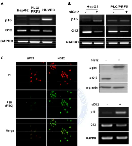 Figure 8.  Restoration  of  p16  expression  by  siGa12  in  HCCs. (A)  Total  RNA  isolated from 2 HCCs and HUVEC normal control cells