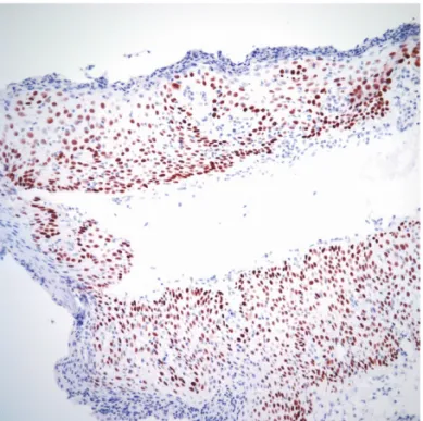 Fig. 5. Histologic findings. A biopsy specimen, from the lesion ob-
