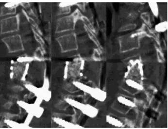 Fig. 5. This drawing illustrates our postulate of cord stretch-