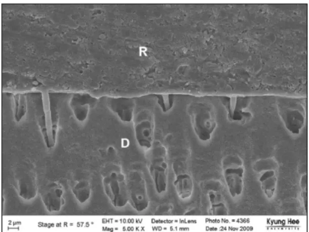 Figure 17. S 3 bond under (×5,000).