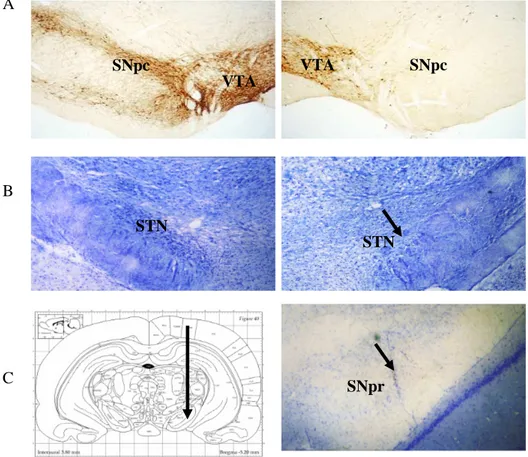 Fig. 2. A: Immunohistochemistry of tyrosine hydroxylase (TH) showing the total  degeneration  of  dopamine  fibers  in  the  striatum,  and  dopamine  cell  bodies  in  the  SNpc on the 6-OHDA injected side (right) compared to the normal side (left)