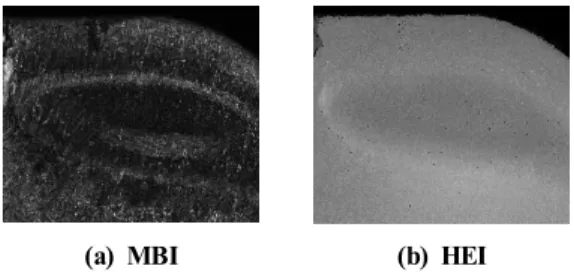 Fig. 5 Crater wear images at several levels after 2D wavelet transform