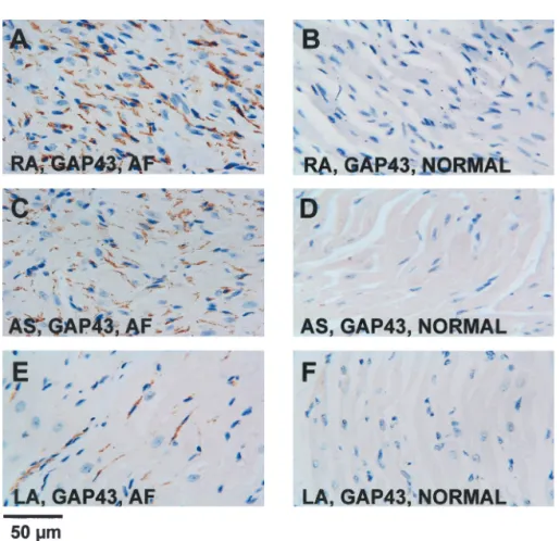Figure 1. GAP43 staining of cardiac