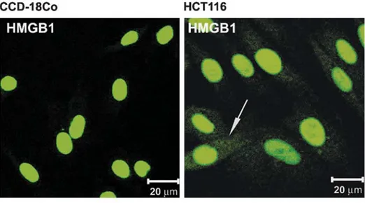 Figure 3 Localization of HMGB1 in CCD-18Co (normal), HCT116 (cancerous) cell lines, normal colonic mucosa, and colon cancer tissues