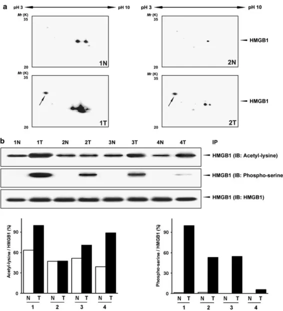 Figure 4 Identification of cytoplasmic phosphorylated HMGB1 in cancer cells. (a) 2DE immunoblot analysis with anti-HMGB1