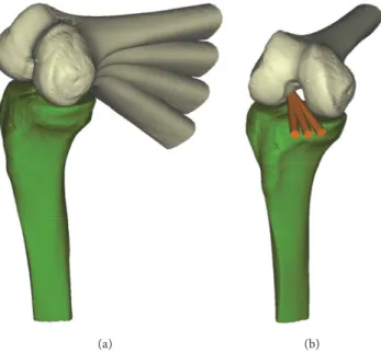Figure 2: Variables at the twelve conditions by combination of flexion angle and transverse drill angle were measured