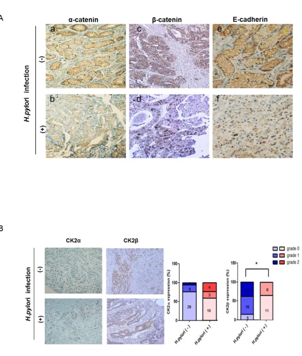 Figure  4.  Immunohistochemical  detection  of  α-catenin,  β-catenin,  E-cadherin,  CK2α  and  CK2β expression in H