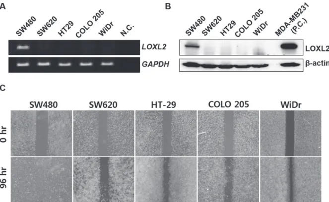 Figure 1: Correlation between LOXL2 expression levels and migratory potential of different CRC cells in vitro