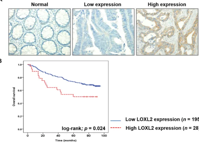 Figure 5: LOXL2 IHC analysis in CRC tissues and the correlation between this parameter and the survival of CRC 