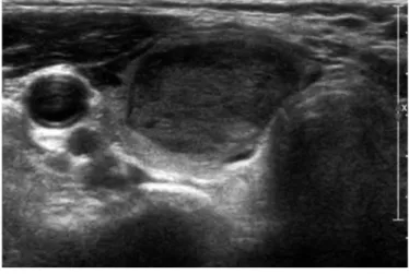 Fig. 3.  A 62-year-old woman with lung cancer. 