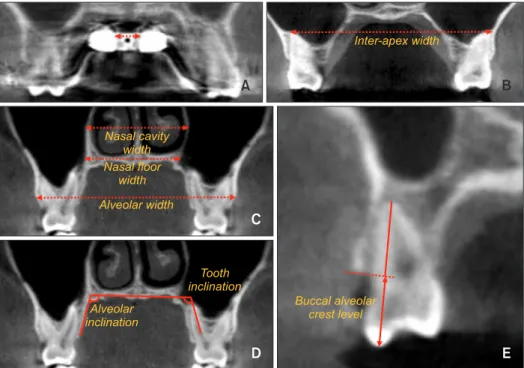 Figure 2. Measurements on the 