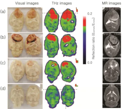 Fig. 1. Visual, THz, and MR images of whole brain images with (a–c) and without (d) tumors