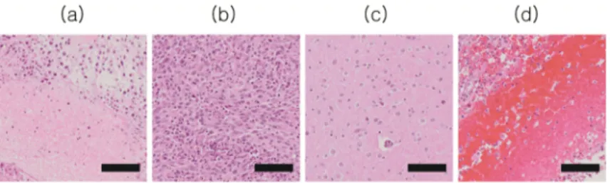 Fig. 5. H&amp;E-stained microscope images of four points on Figs. 4(a) and 4(b). (a) Microscope  image of a center of a tumor in Fig