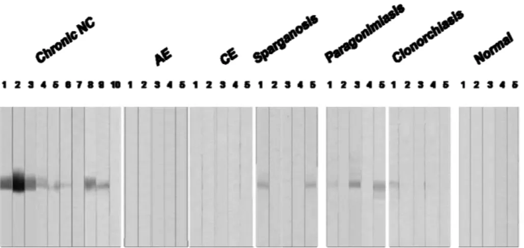 Fig.  9.  Assessment  of  diagnostic  applicability  of  rTsMFc.  The  rTsMFc  separated by 10% SDS-PAGE in reducing condition was transferblotted onto  PVDF  membrane