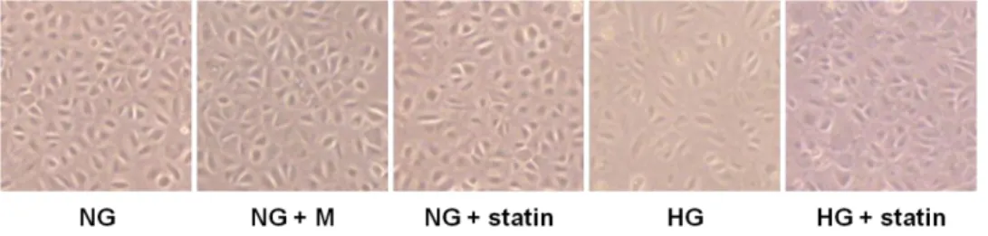 Figure 3. Morphologic changes under an inverted phase-contrast microscope in  HPMCs exposed to 5.6 mM glucose (NG), NG + mannitol (94.4 mM, NG + M),  NG + 1 µM simvastatin (NG + statin), high glucose (100 mM, HG), or HG + 1  µM simvastatin (HG + statin)