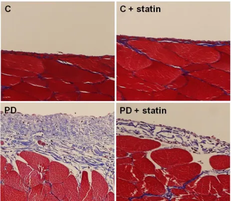 Figure  9.  Masson’s  trichrome  staining  of  the  peritoneum  of  control  (C),  C+  simvastatin  (C  +  statin),  4.25%  PDF  instillation  (PD),  or  4.25%  PDF  +  simvastatin  (PD  +  statin)  rats
