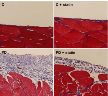 Figure 9. Masson’s trichrome staining of the peritoneum of control (C), C+ simvastatin (C + statin), 4.25% PDF instillation (PD), or 4.25% PDF + simvastatin (PD + statin) rats