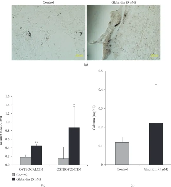 Figure 4: Eﬀect of glabridin on osteogenesis in MSCs. (a) Osteogenic diﬀerentiation was evaluated by von Kossa staining (magniﬁcation: