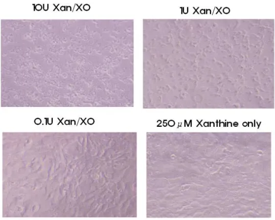 Figure 4. Morphological changes in mouse hepatocytes treated with xanthine oxidase.  Optical  microscopic  examination  showed  a  significant  xanthine  oxidase  dependent  morphological change and increase of necrotic debri 