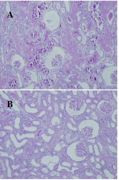 Figure 10.  The  renal histology  of vehicle-treated kidney (A)  and GTP-treated kidney (B) with PAS stain after 90 minutes  of  ischemia,  followed  by  24  hours  of  reperfusion