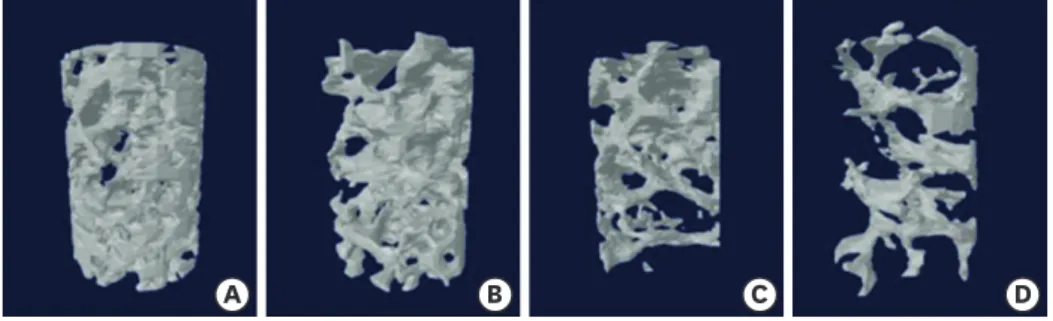Figure 2.  Three-dimensional images of representative cancellous bone cores. Cancellous bone density is  classified into 4 categories based on HU