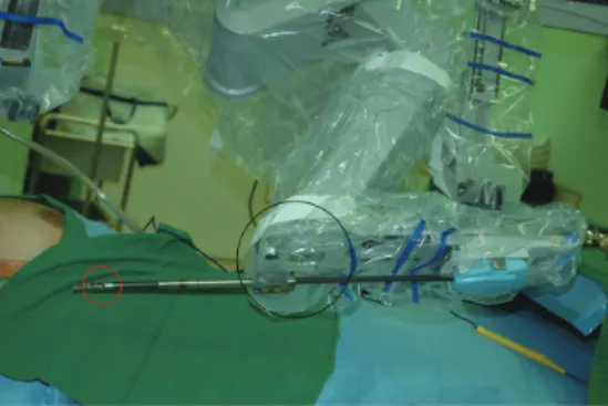 Figure 7 Parts of the ProGrasp forceps are showing; red circle 