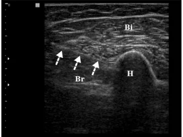 Fig. 4. Transverse ultrasound image by the in-plane 