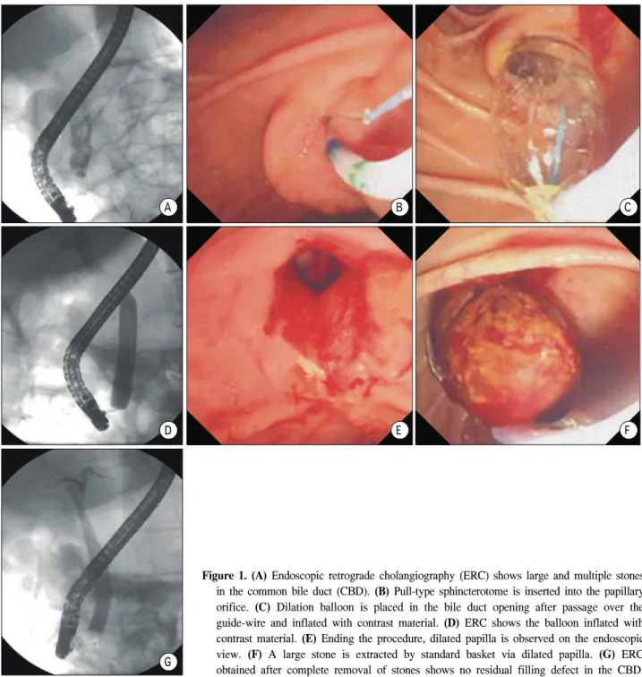Table  2.  Results  of  the  Procedure