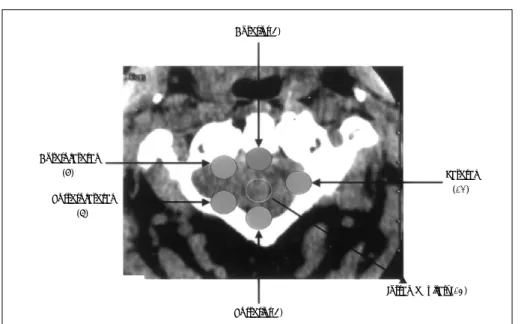 Table 2. Location of tumor 