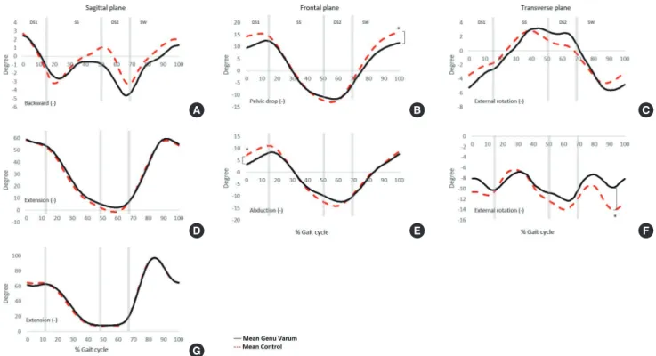Figure 2.Stairdescentensembleaveragepelvic(top),knee(middle),andknee(lower)kinematicsforsagittal(left),frontal(middle),transverse  (right)planesforgenuvarum(solidline)andcontrol(dottedline)groups.ThepositivevaluesmeanA:p