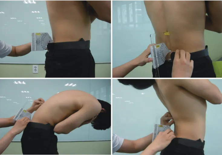 Figure 1.FlexionandextensionexaminationbyBROM(backrange-of-motioninstrument)II.