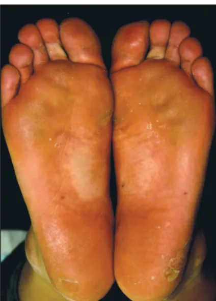 Fig. 2.  Skin biopsy specimen of the former patient shows no  remarkable pathologic findings (H&amp;E, ×100).
