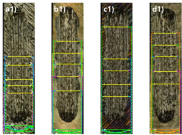Fig. 8. Comparison in surface profiles and 3D LSM  images of counter ball slid against of the RT untreated  (a1, a2), RT UNSM-treated (b1, b2), HT400 untreated  (c1, c2) and HT UNSM-treated (d1, d2) specimens.