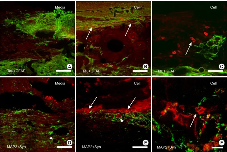 Fig.  5.  Immunohistochemistry  in  the  spinal  cords  8  weeks  after  transplantation