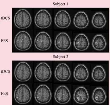Figure 1.  The average map cortical acticvation induced  by the tDCS and FES during functional MRI