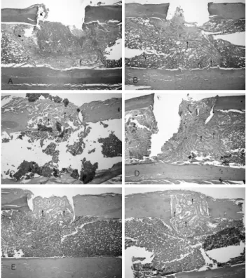 Figure 1. Histological finding of bone healing (H 