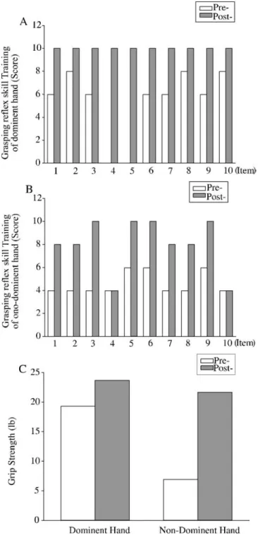 Figure 4. Effect of Grasping Reflex Skill and Grip  Strength in Case 4. (A) Dominent hand (B) Non-dominent hand (C) Grip Strength