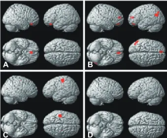 Fig. 3. The results of Kawabata and Zeki. 22)  Statistical parametric  maps rendered onto a standard brain showing judgment-specific  activity in comparisons of beautiful vs